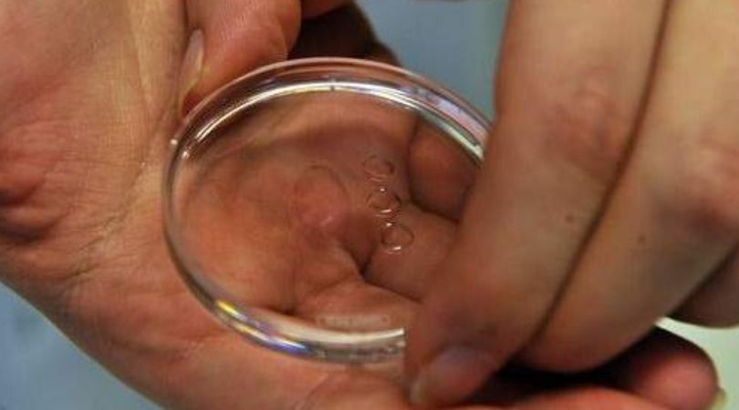 Pembuahan dengan Sperma Suami yang Diawetkan Setelah Suami Meninggal, Konsultasi Syariah-min